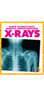 X-Rays